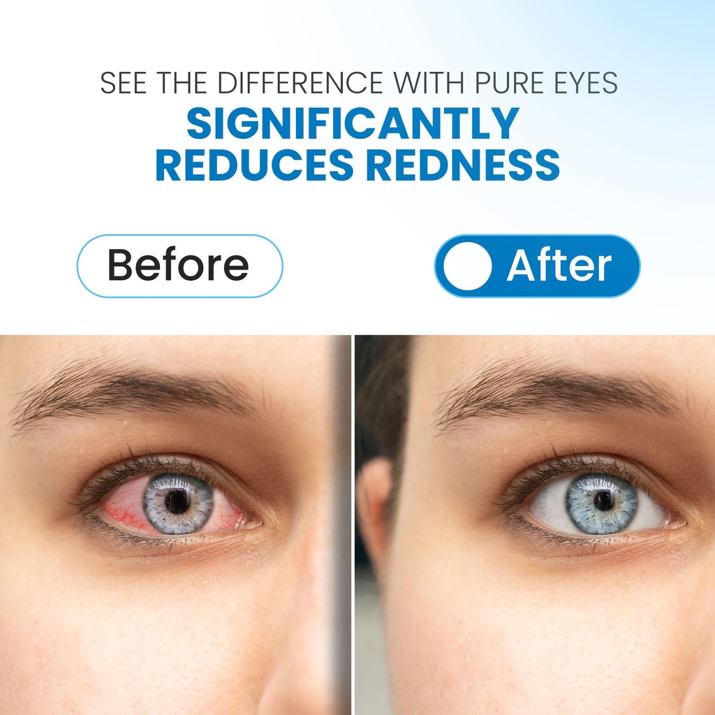 Pure Eyes  0.24 FL OZ (7 mL ) Maximum Redness Relief  12ct-Box